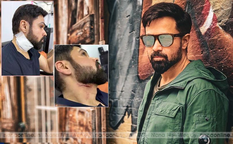 'ഗൂഢാചാരി 2' സെറ്റിൽ അപകടം; ബോളിവുഡ് താരം ഇമ്രാൻ ഹാഷ്മിക്ക് പരിക്ക് 